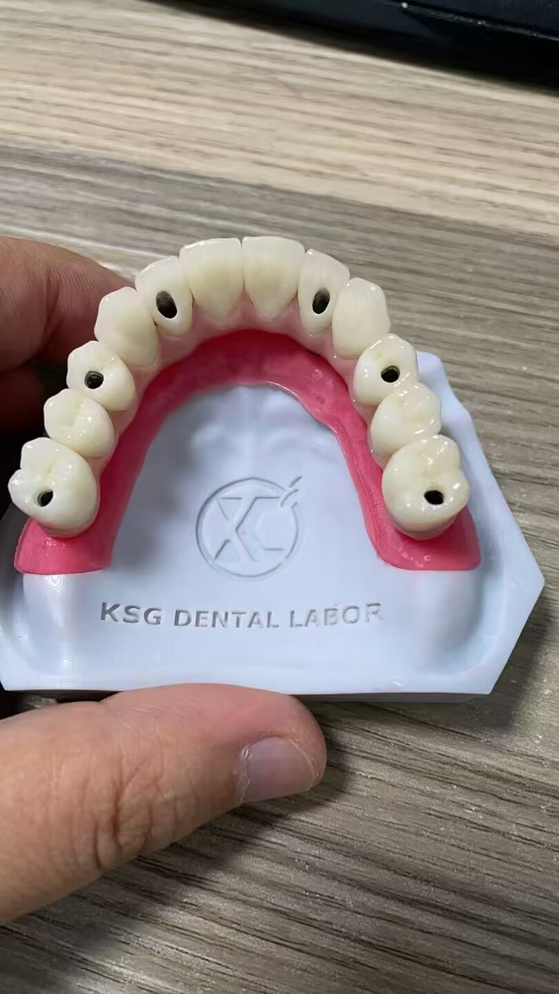 China Dental Crown L